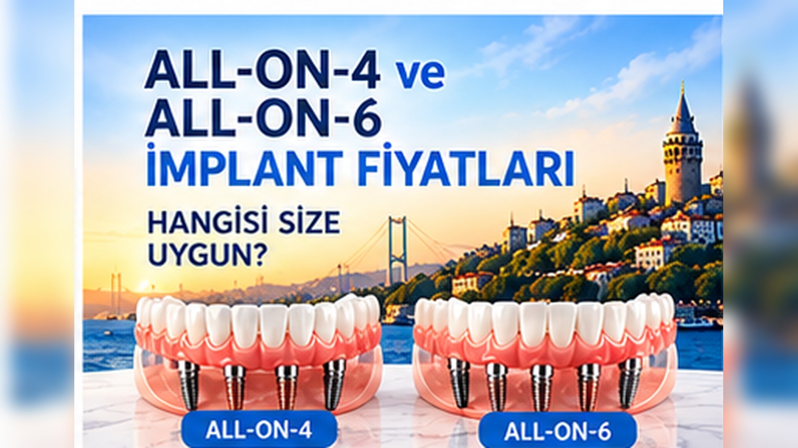 All-on-4 ve All-on-6 implant fiyatları Türkiye