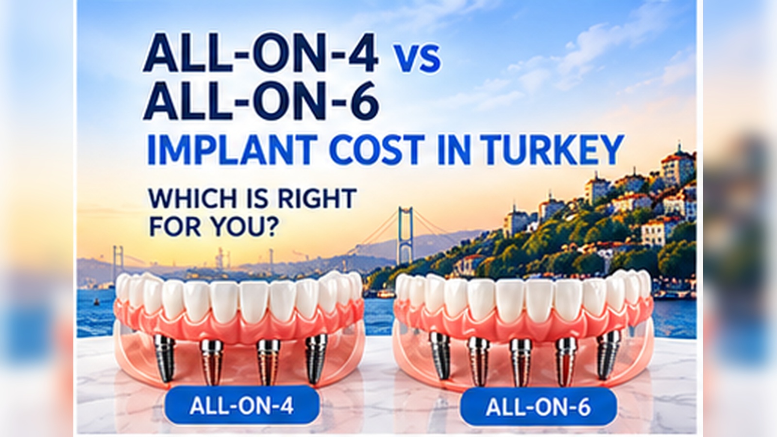 All-on-4 versus All-on-6 implant cost in Turkey