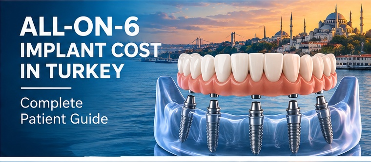 All-on-6 implant cost in Turkey patient guide