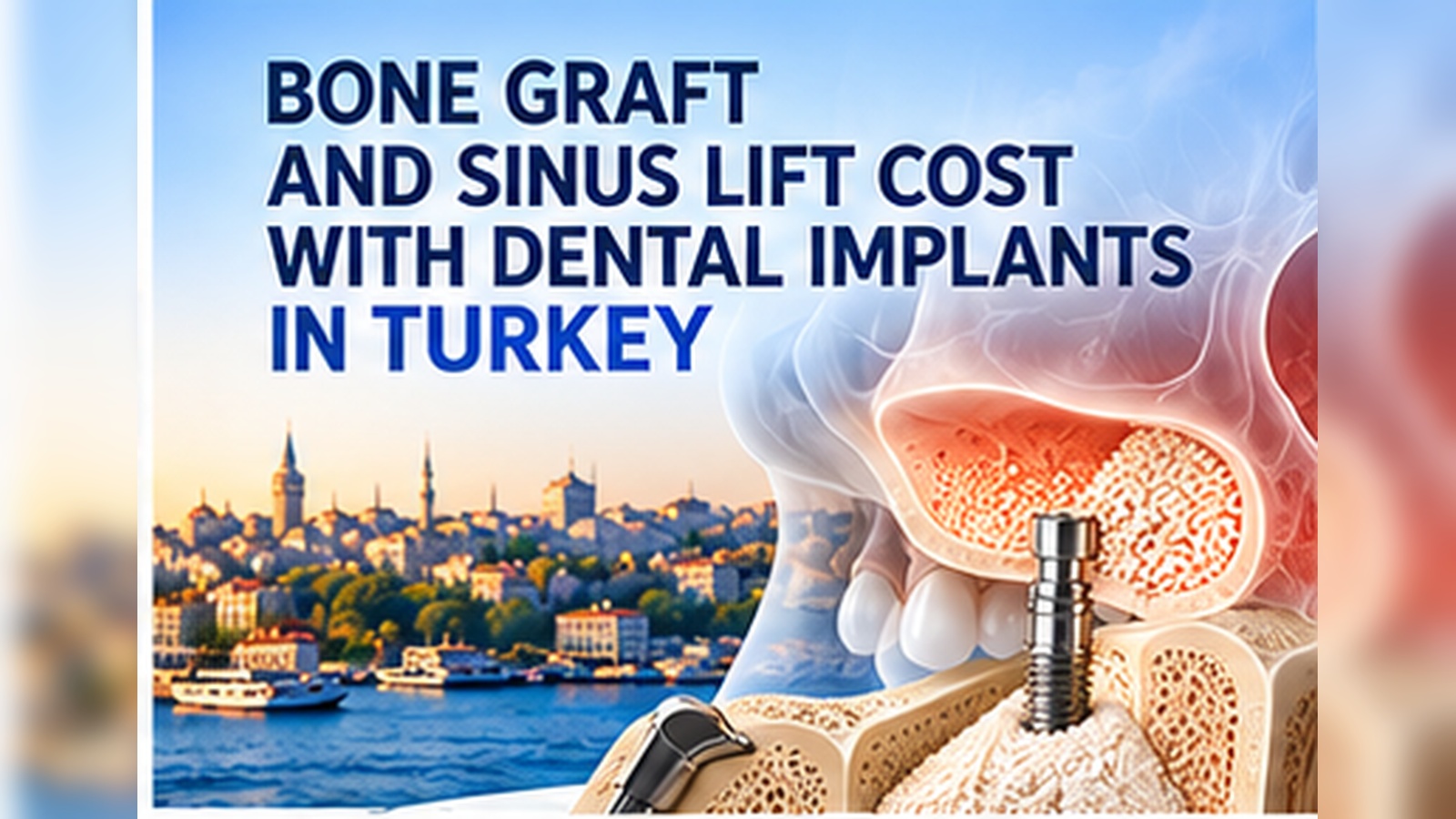 Bone graft sinus lift and implant cost in Turkey
