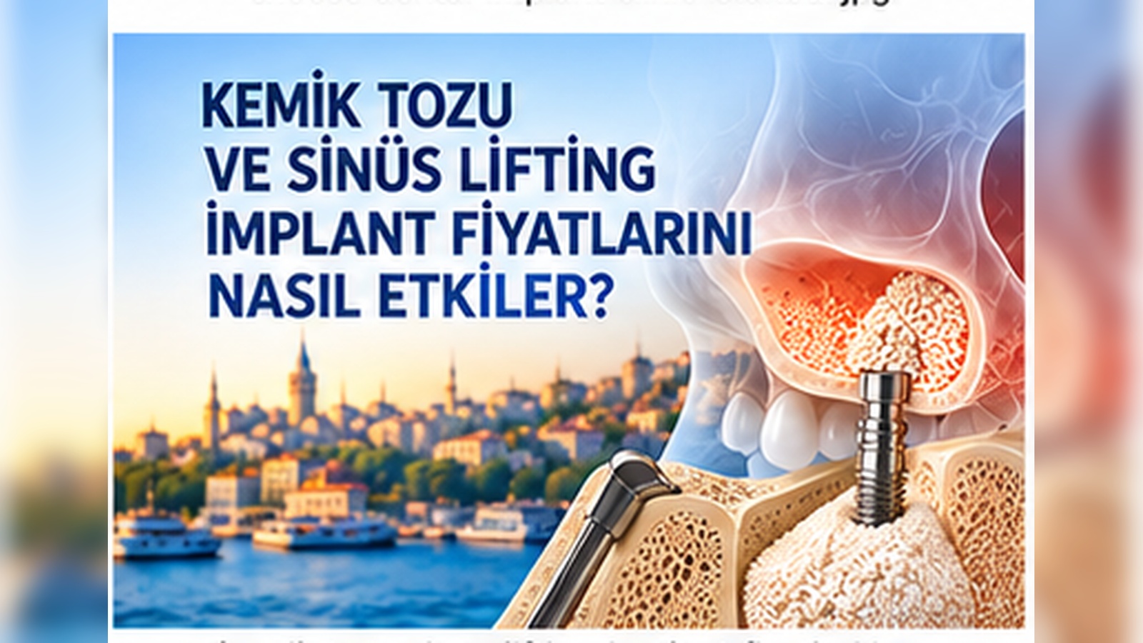 Kemik Tozu ve Sinüs Lifting İmplant Fiyatlarını Nasıl Etkiler?