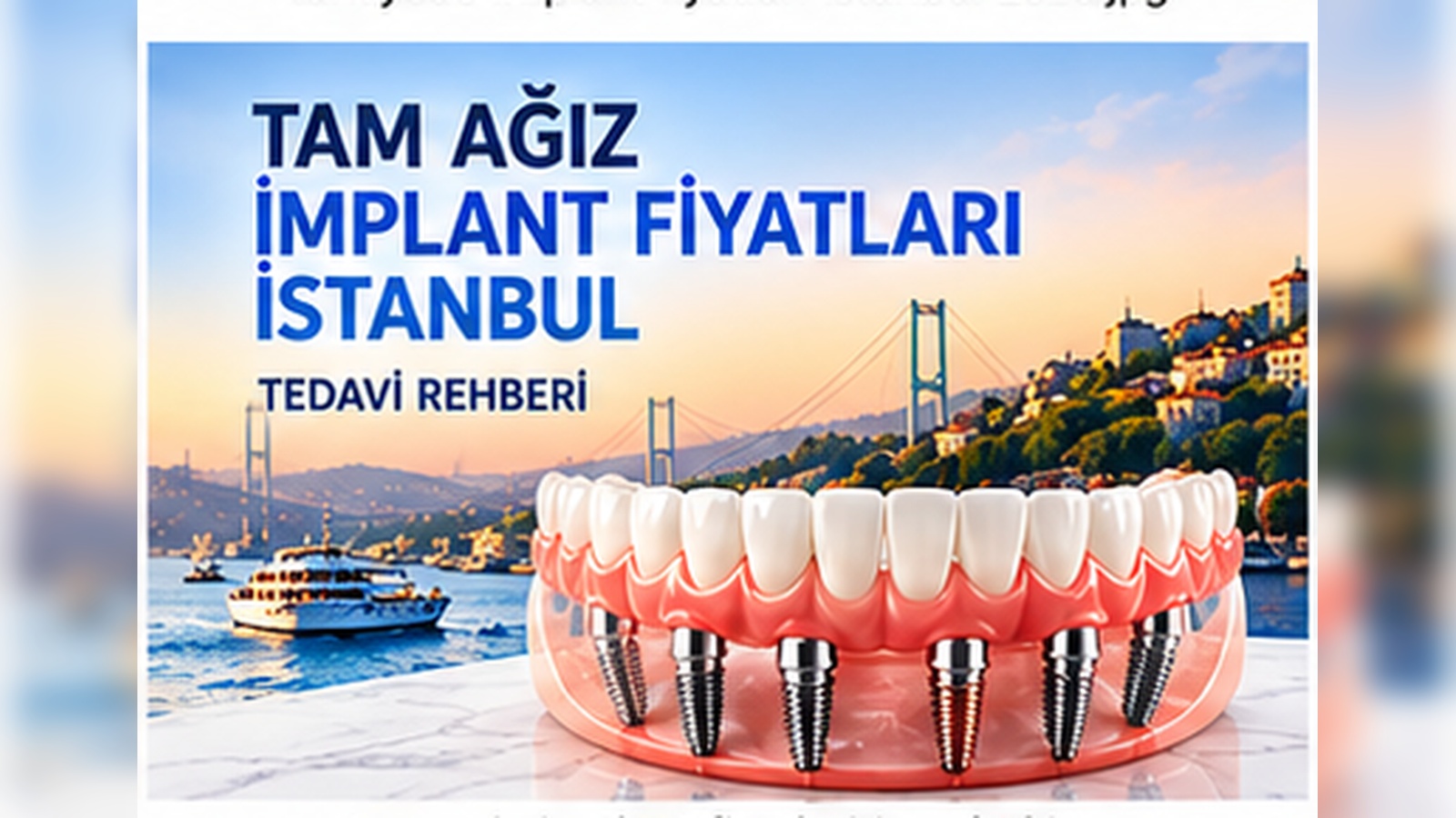 Tam Ağız İmplant Fiyatları İstanbul: Tedavi Rehberi