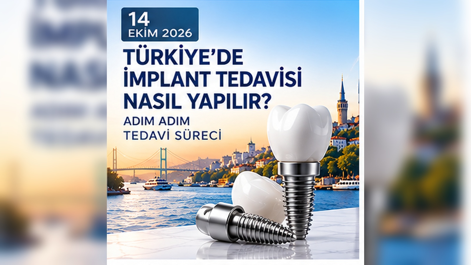 Türkiye'de İmplant Tedavisi Nasıl Yapılır? Adım Adım Tedavi Süreci