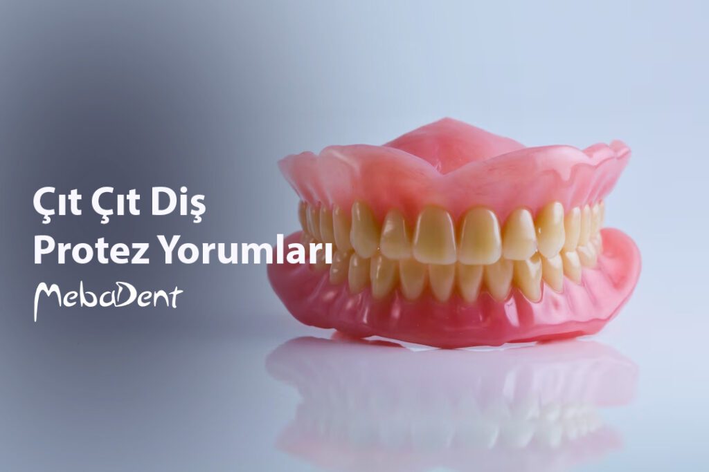 Çıt Çıt Diş Protez Yorumları