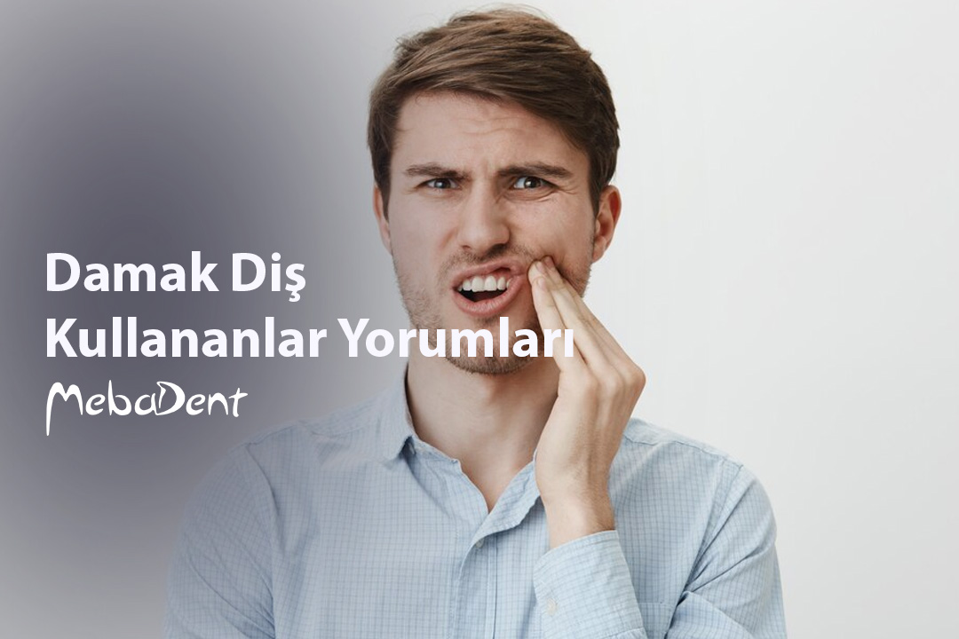 Damak Diş Kullananlar Yorumları