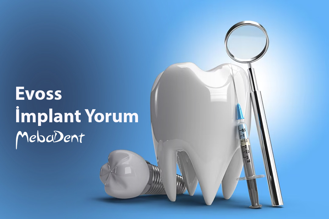 Evoss İmplant Yorum