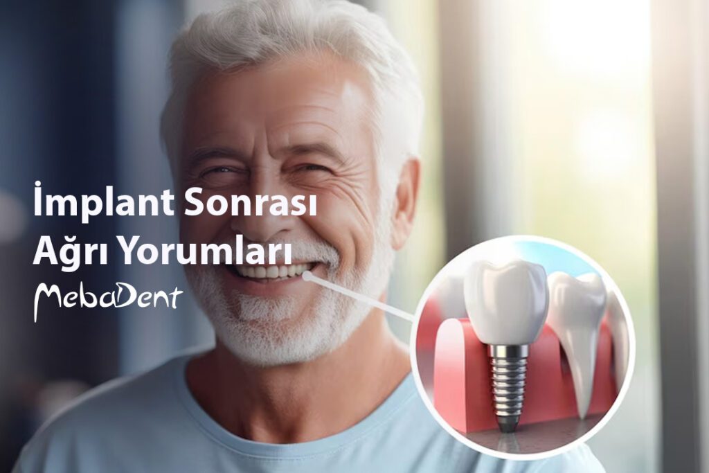 İmplant Sonrası Ağrı Yorumları