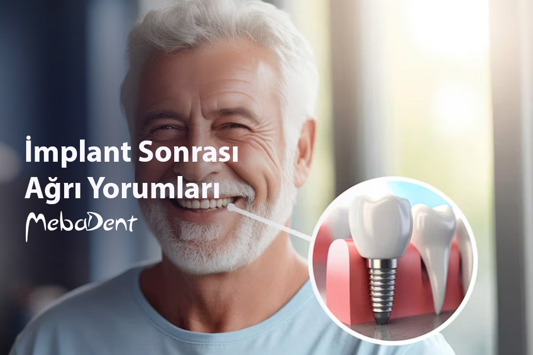 İmplant Sonrası Ağrı Yorumları