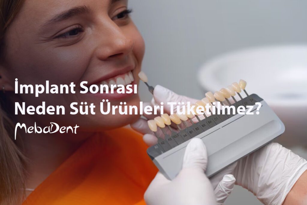 İmplant Sonrası Neden Süt Ürünleri Tüketilmez?