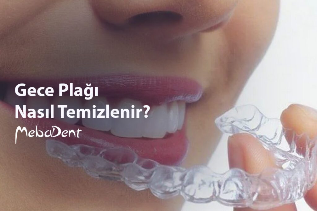 Gece Plağı Nasıl Temizlenir?