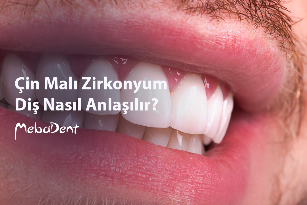 Çin Malı Zirkonyum Diş Nasıl Anlaşılır?