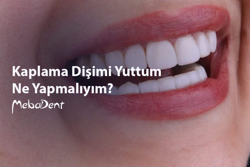 Kaplama Dişimi Yuttum, Ne Yapmalıyım?