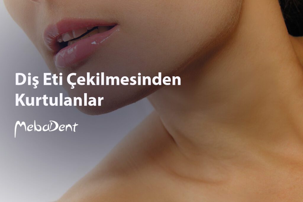 Diş Eti Çekilmesinden Kurtulanlar