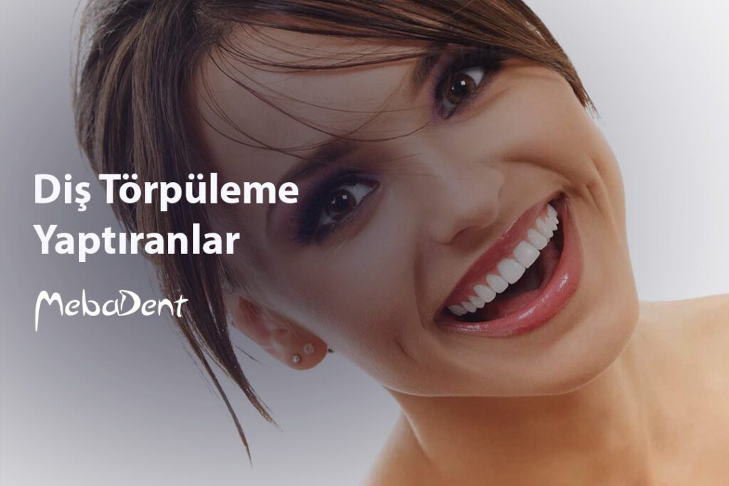 Diş Törpüleme Yaptıranlar