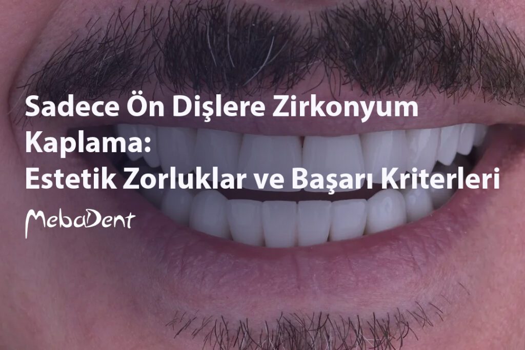 Sadece Ön Dişlere Zirkonyum Kaplama: Estetik Zorluklar ve Başarı Kriterleri