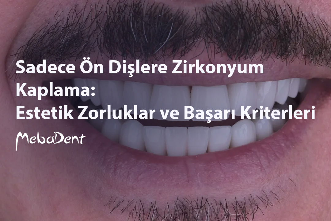 Sadece Ön Dişlere Zirkonyum Kaplama: Estetik Zorluklar ve Başarı Kriterleri