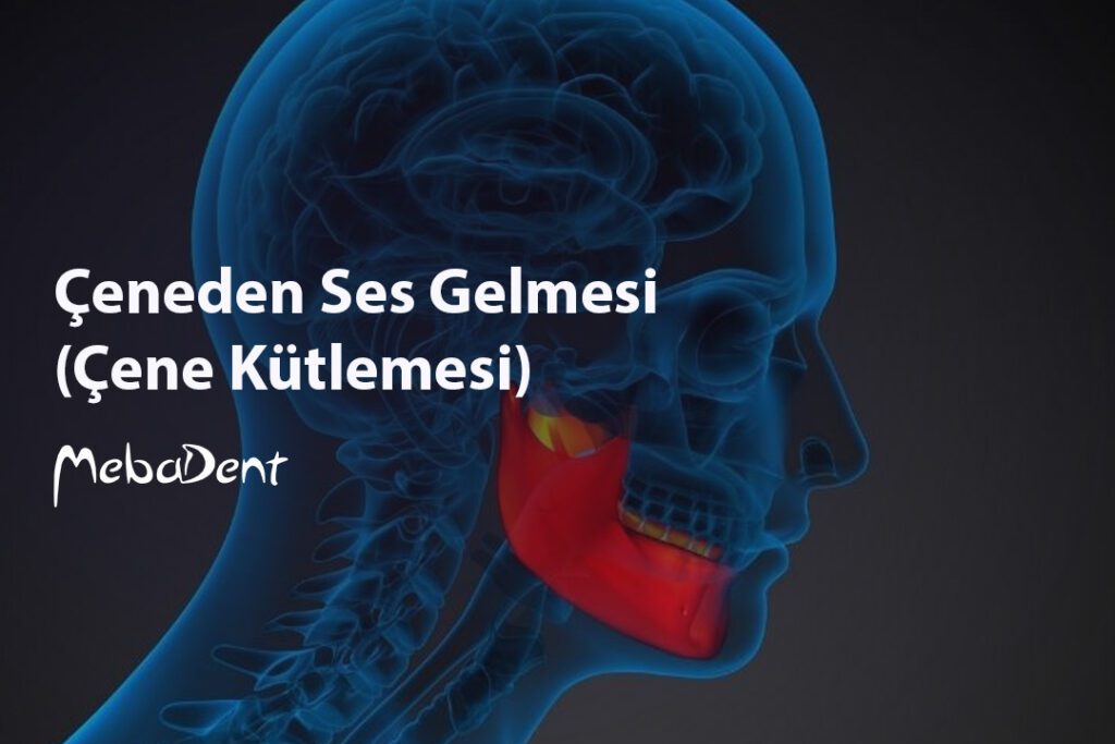 Çeneden Ses Gelmesi (Çene Kütlemesi)