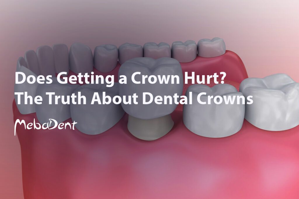 Does Getting a Crown Hurt? The Truth About Dental Crowns