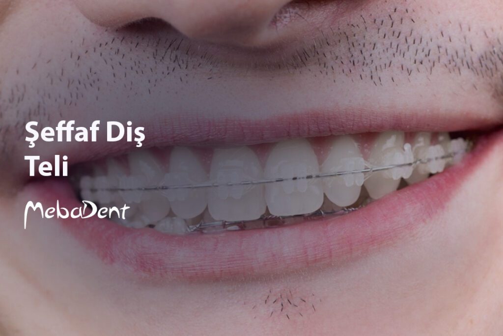 Şeffaf Diş Teli