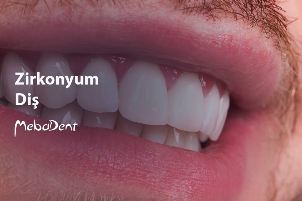 Zirkonyum Diş