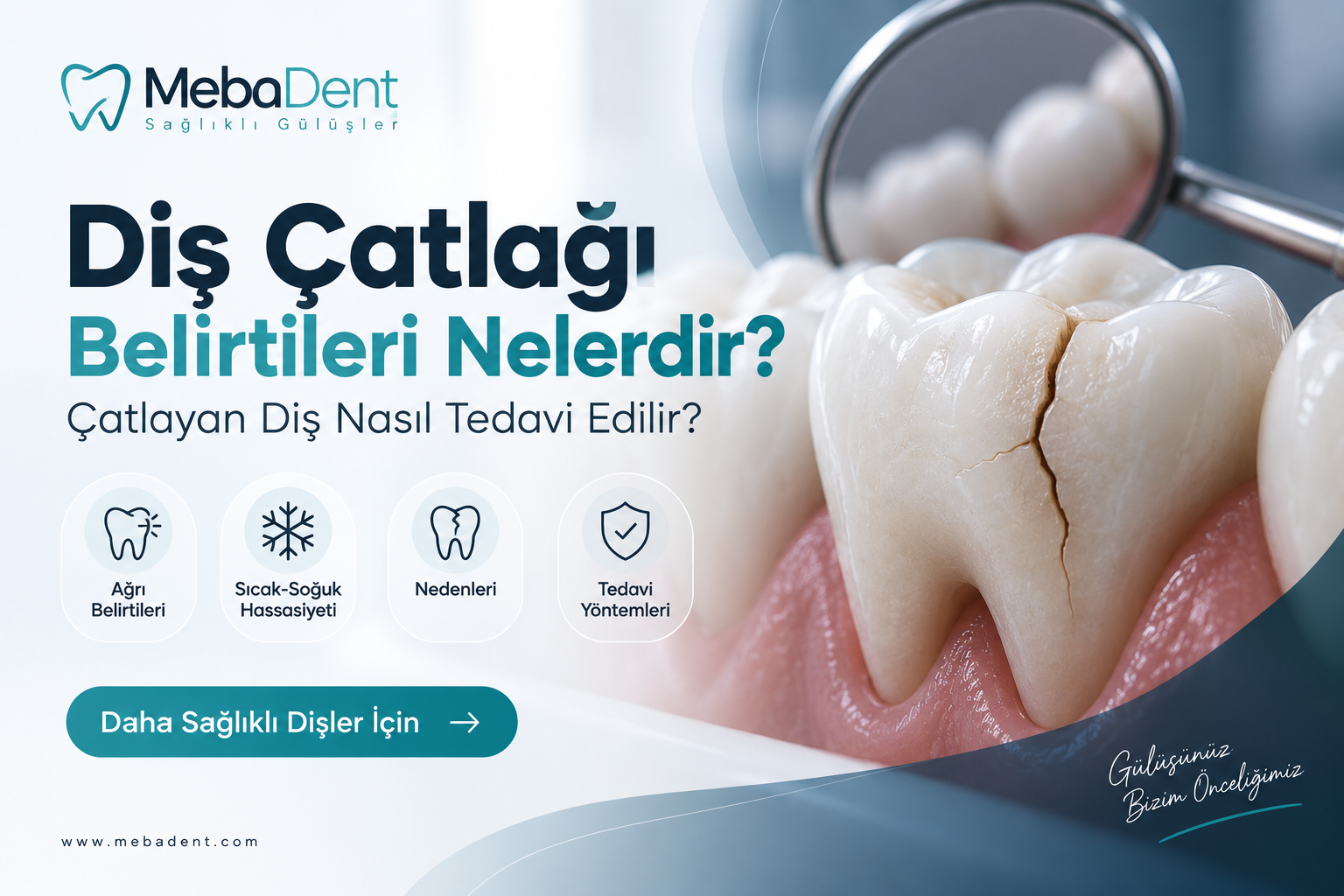 Diş Çatlağı Belirtileri Nelerdir? Çatlayan Diş Nasıl Tedavi Edilir?