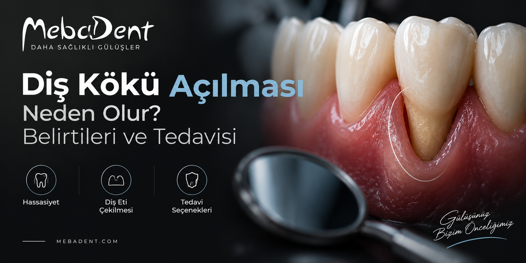 Diş Kökü Açılması Neden Olur? Belirtileri ve Tedavisi