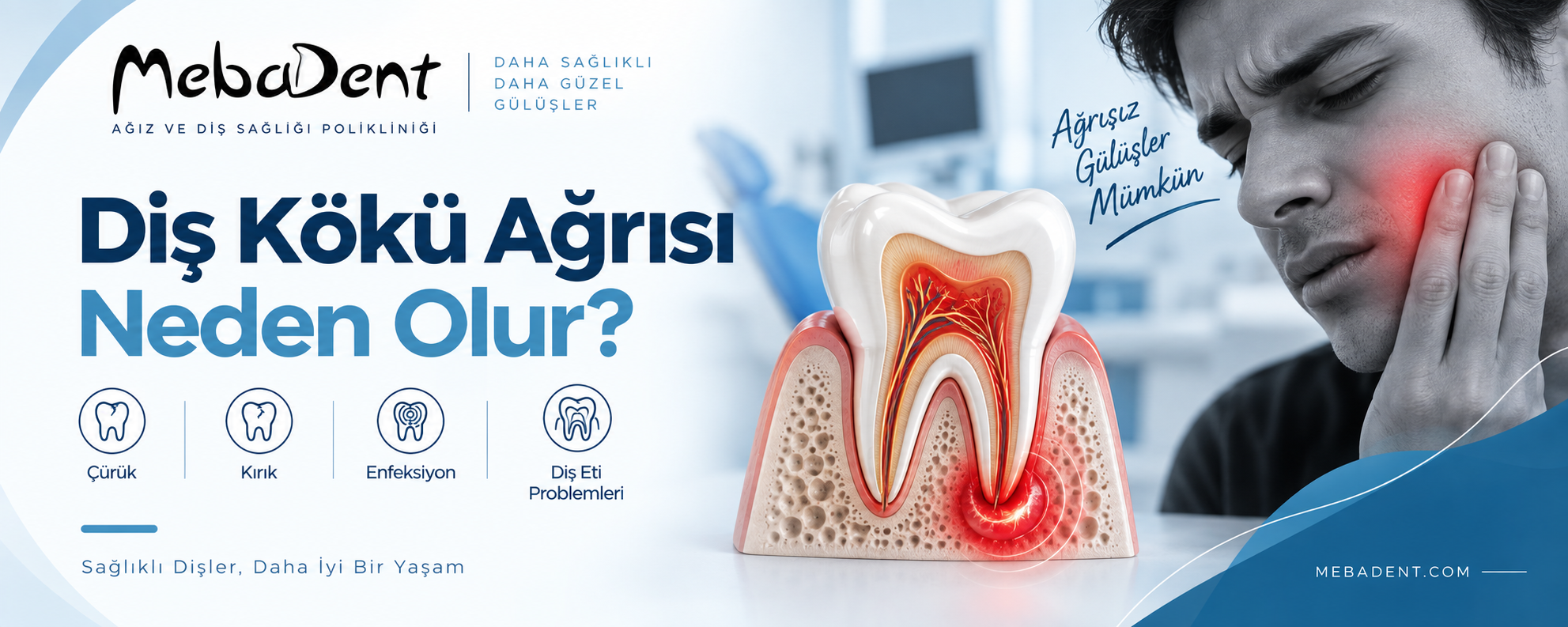 Diş Kökü Ağrısı Neden Olur?