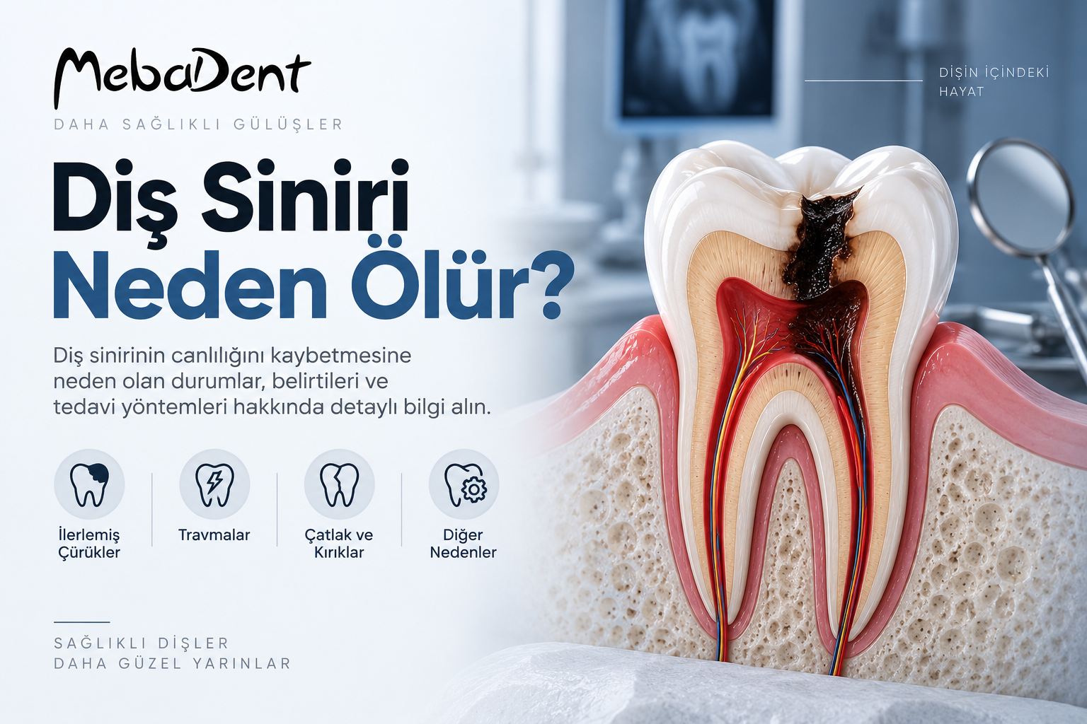 Diş Siniri Neden Ölür?